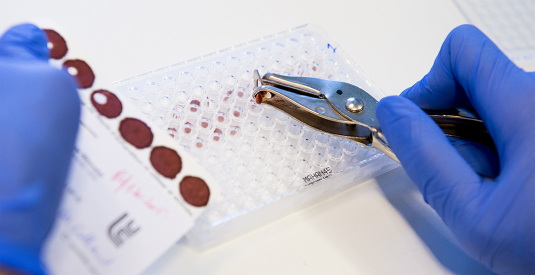 L’Institut des maladies rares fait désormais partie des réseaux ERN (European Reference Networks) de maladies rares. 